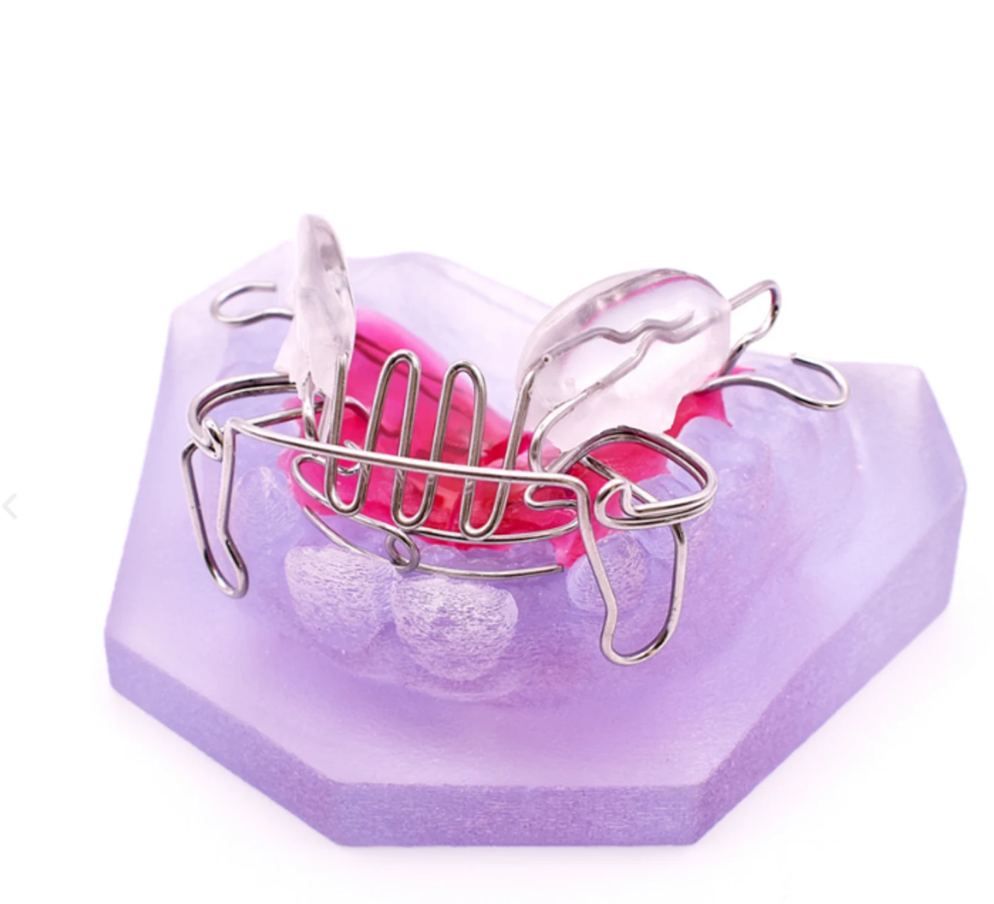 Aparato removible de ortopedia funcional con base de acrílico rosa, escudos laterales transparentes y alambres, sobre un modelo dental.